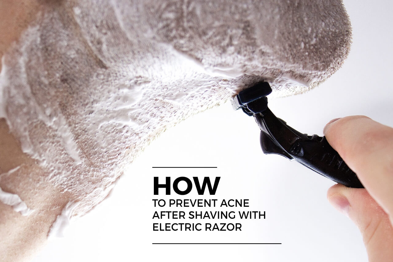 how-to-prevent-acne-after-shaving-with-electric-razor-barbers-corner